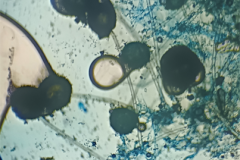 Aspergillus-idos