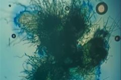 Chaetomium
